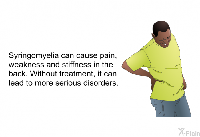 Syringomyelia can cause pain, weakness and stiffness in the back. Without treatment, it can lead to more serious disorders.