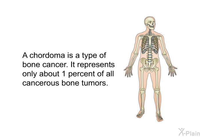 A chordoma is a type of bone cancer. It represents only about 1 percent of all cancerous bone tumors.