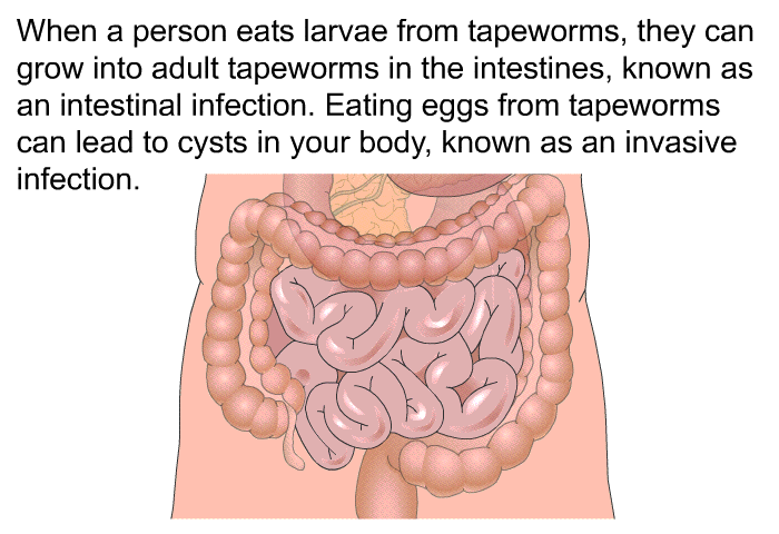When a person eats larvae from tapeworms, they can grow into adult tapeworms in the intestines, known as an intestinal infection. Eating eggs from tapeworms can lead to cysts in your body, known as an invasive infection.