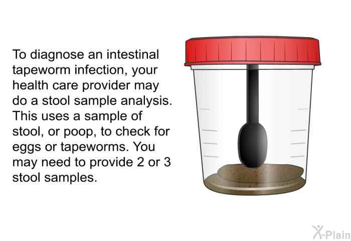 To diagnose an intestinal tapeworm infection, your health care provider may do a stool sample analysis. This uses a sample of stool, or poop, to check for eggs or tapeworms. You may need to provide 2 or 3 stool samples.