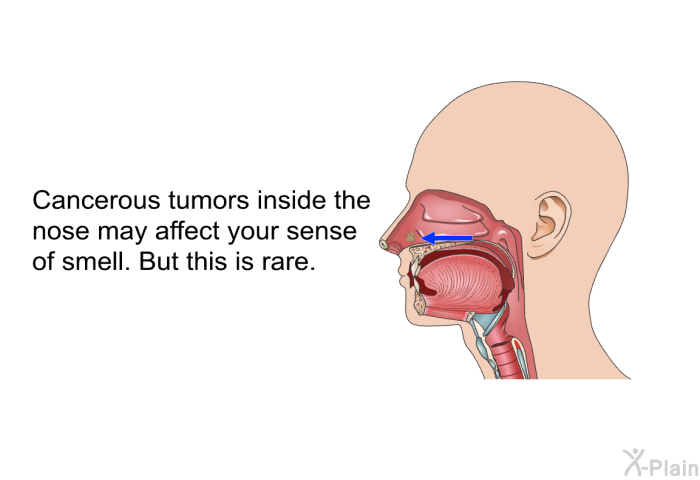 Cancerous tumors inside the nose may affect your sense of smell. But this is rare.