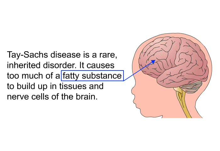 Tay-Sachs disease is a rare, inherited disorder. It causes too much of a fatty substance to build up in tissues and nerve cells of the brain.