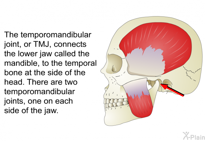 The temporomandibular joint, or TMJ, connects the lower jaw called the mandible, to the temporal bone at the side of the head. There are two temporomandibular joints, one on each side of the jaw.