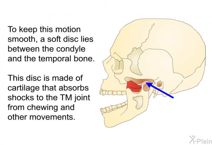 To keep this motion smooth, a soft disc lies between the condyle and the temporal bone. This disc is made of cartilage that absorbs shocks to the TM joint from chewing and other movements.