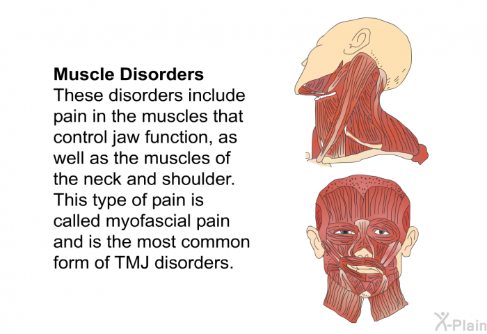 <B>Muscle Disorders</B> These disorders include pain in the muscles that control jaw function, as well as the muscles of the neck and shoulder. This type of pain is called <I>myofascial pain</I> and is the most common form of TMJ disorders.