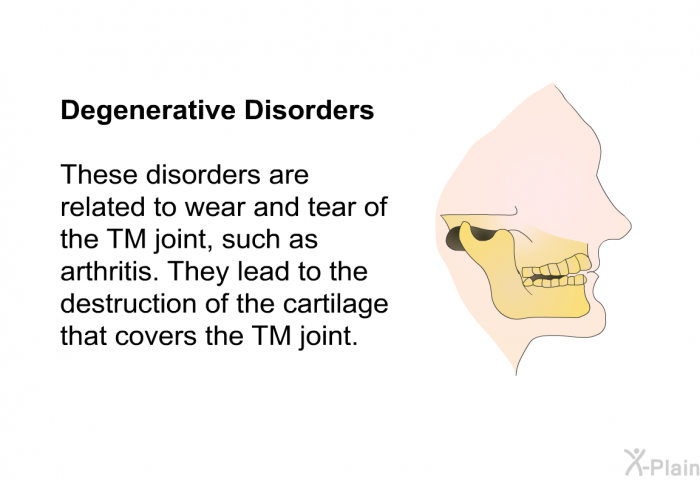 <B>Degenerative Disorders</B> These disorders are related to wear and tear of the TM joint, such as arthritis. They lead to the destruction of the cartilage that covers the TM joint.