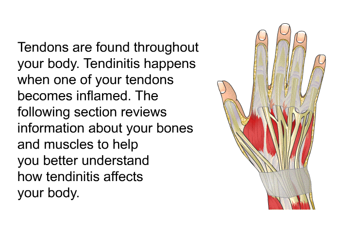 Tendons are found throughout your body. Tendinitis happens when one of your tendons becomes inflamed. The following section reviews information about your bones and muscles to help you better understand how tendinitis affects your body.