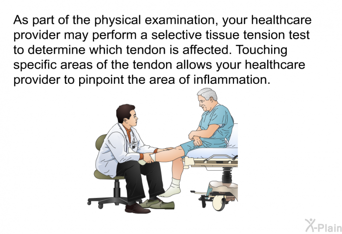 As part of the physical examination, your healthcare provider may perform a selective tissue tension test to determine which tendon is affected. Touching specific areas of the tendon allows your healthcare provider to pinpoint the area of inflammation.