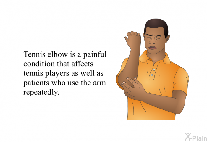 Tennis elbow is a painful condition that affects tennis players as well as patients who use the arm repeatedly.