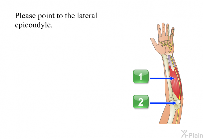 Please point to the lateral epicondyle.