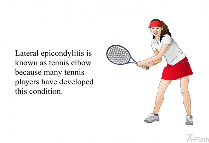 Lateral epicondylitis is known as tennis elbow because many tennis players have developed this condition.