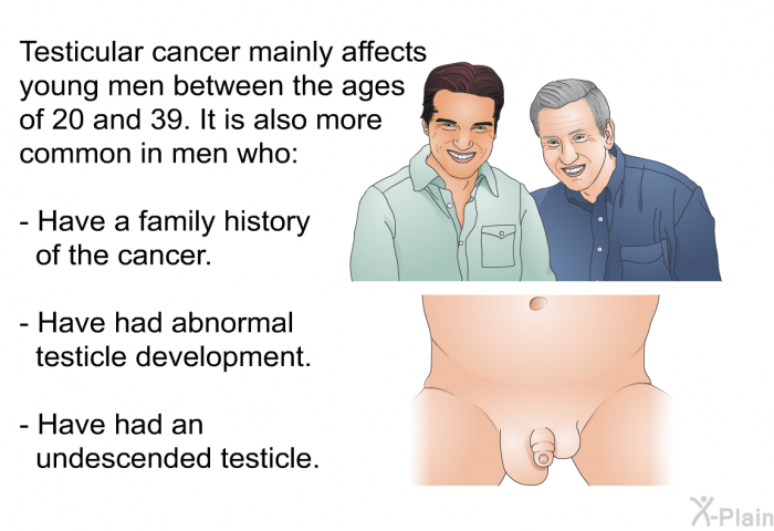 Testicular cancer mainly affects young men between the ages of 20 and 39. It is also more common in men who:  Have a family history of the cancer. Have had abnormal testicle development. Have had an undescended testicle.