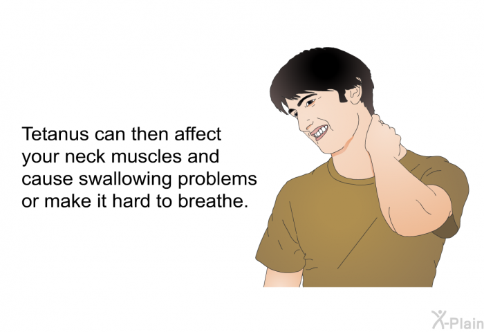 Tetanus can then affect your neck muscles and cause swallowing problems or make it hard to breathe.