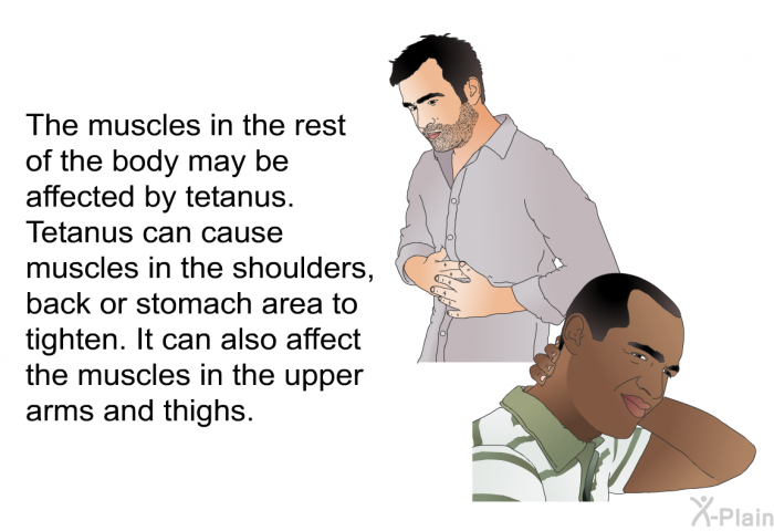 The muscles in the rest of the body may be affected by tetanus. Tetanus can cause muscles in the shoulders, back or stomach area to tighten. It can also affect the muscles in the upper arms and thighs.