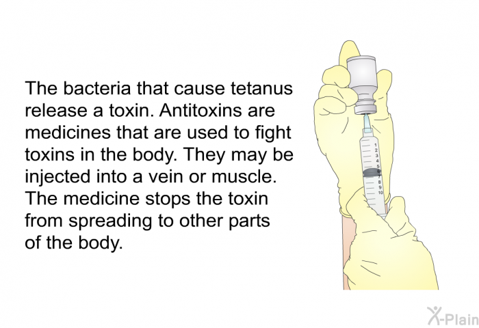 The bacteria that cause tetanus release a toxin. Antitoxins are medicines that are used to fight toxins in the body. They may be injected into a vein or muscle. The medicine stops the toxin from spreading to other parts of the body.