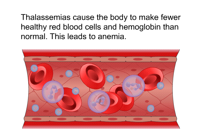Thalassemias cause the body to make fewer healthy red blood cells and hemoglobin than normal. This leads to anemia.