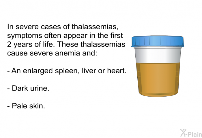 In severe cases of thalassemias, symptoms often appear in the first 2 years of life. These thalassemias cause severe anemia and:  An enlarged spleen, liver or heart. Dark urine. Pale skin.