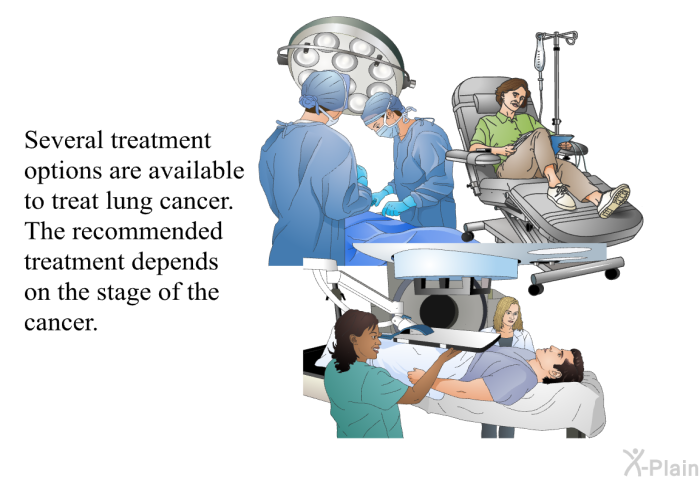 Several treatment options are available to treat lung cancer. The recommended treatment depends on the stage of the cancer.