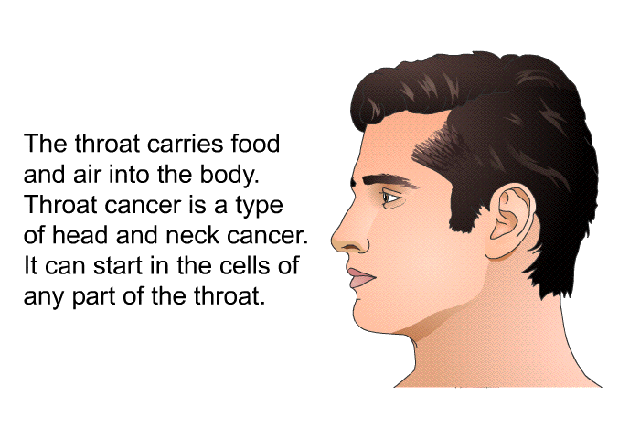 The throat carries food and air into the body. Throat cancer is a type of head and neck cancer. It can start in the cells of any part of the throat.
