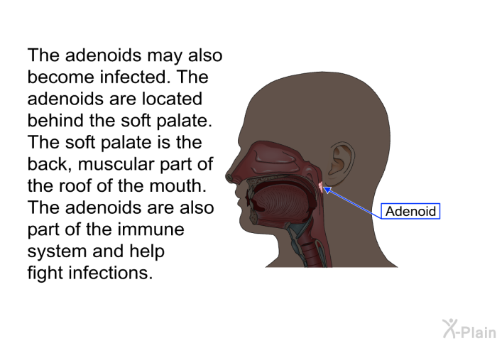 The adenoids may also become infected. The adenoids are located behind the soft palate. The soft palate is the back, muscular part of the roof of the mouth. The adenoids are also part of the immune system and help fight infections.