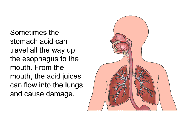 Sometimes the stomach acid can travel all the way up the esophagus to the mouth. From the mouth, the acid juices can flow into the lungs and cause damage.