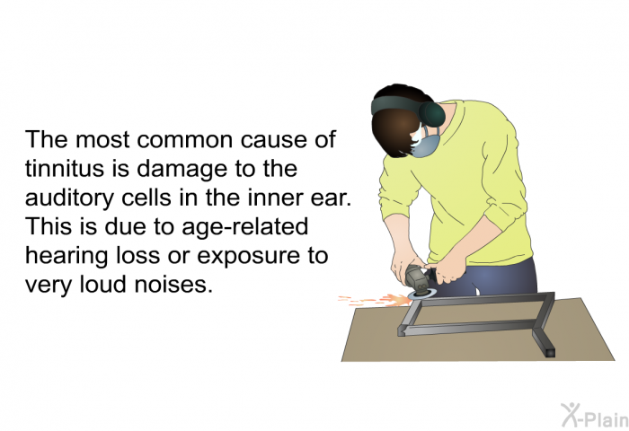 The most common cause of tinnitus is damage to the auditory cells in the inner ear. This is due to age-related hearing loss or exposure to very loud noises.