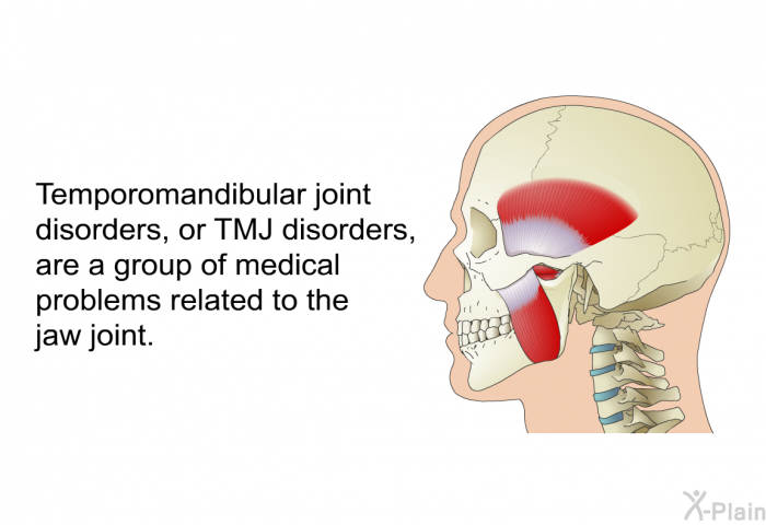 Temporomandibular joint disorders, or TMJ disorders, are a group of medical problems related to the jaw joint.