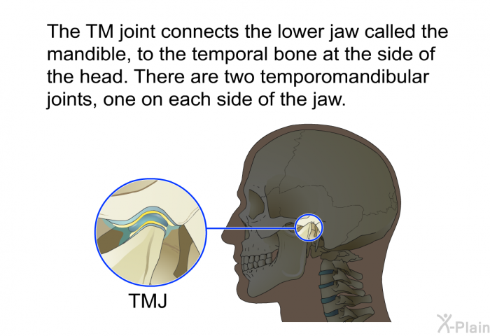 The TM joint connects the lower jaw called the mandible, to the temporal bone at the side of the head. There are two temporomandibular joints, one on each side of the jaw.