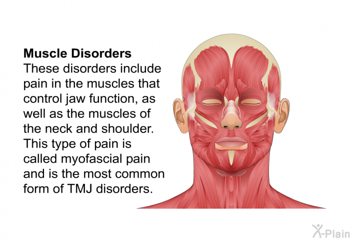 <B>Muscle Disorders</B>
These disorders include pain in the muscles that control jaw function, as well as the muscles of the neck and shoulder. This type of pain is called myofascial pain and is the most common form of TMJ disorders.