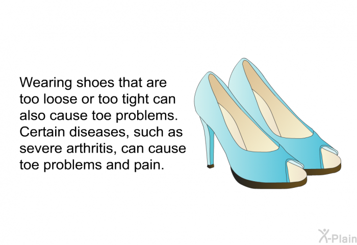 Wearing shoes that are too loose or too tight can also cause toe problems. Certain diseases, such as severe arthritis, can cause toe problems and pain.
