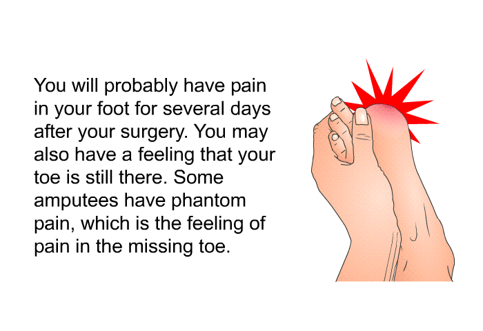 You will probably have pain in your foot for several days after your surgery. You may also have a feeling that your toe is still there. Some amputees have phantom pain, which is the feeling of pain in the missing toe.