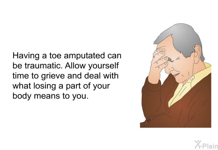 Having a toe amputated can be traumatic. Allow yourself time to grieve and deal with what losing a part of your body means to you.