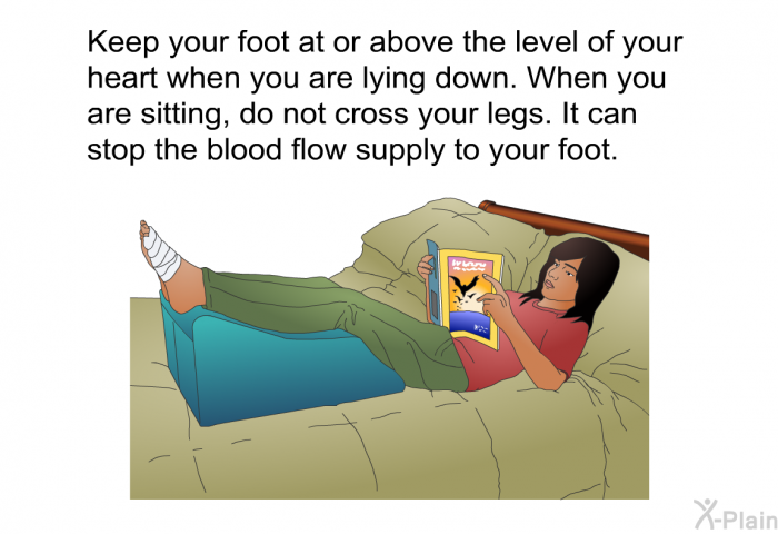Keep your foot at or above the level of your heart when you are lying down. When you are sitting, do not cross your legs. It can stop the blood flow supply to your foot.