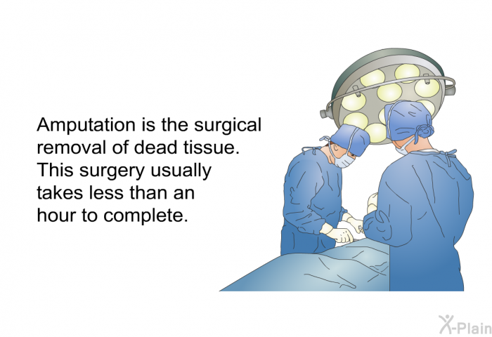 Amputation is the surgical removal of dead tissue. This surgery usually takes less than an hour to complete.