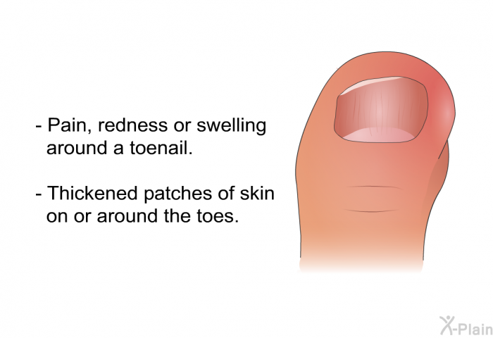Pain, redness or swelling around a toenail. Thickened patches of skin on or around the toes.