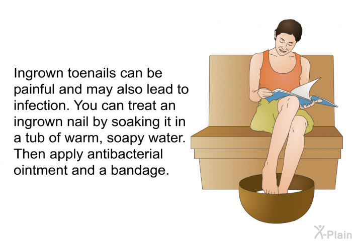 Ingrown toenails can be painful and may also lead to infection. You can treat an ingrown nail by soaking it in a tub of warm, soapy water. Then apply antibacterial ointment and a bandage.