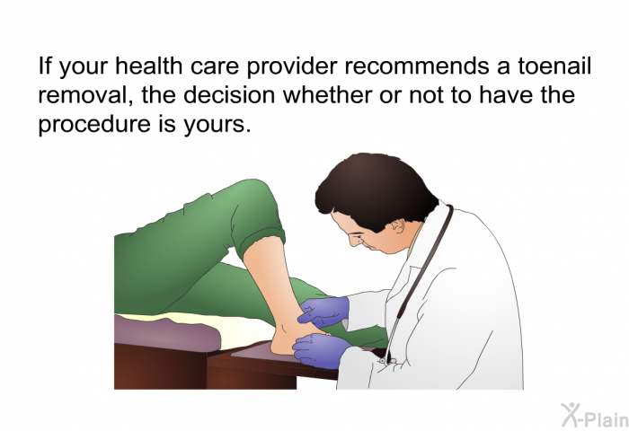 If your health care provider recommends a toenail removal, the decision whether or not to have the procedure is yours.