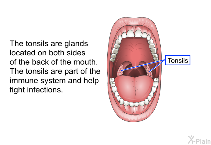 The tonsils are glands located on both sides of the back of the mouth. The tonsils are part of the immune system and help fight infections.