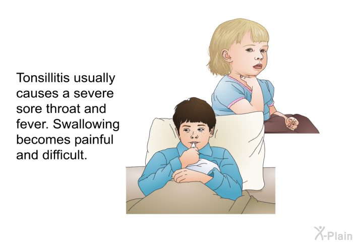 Tonsillitis usually causes a severe sore throat and fever. Swallowing becomes painful and difficult.