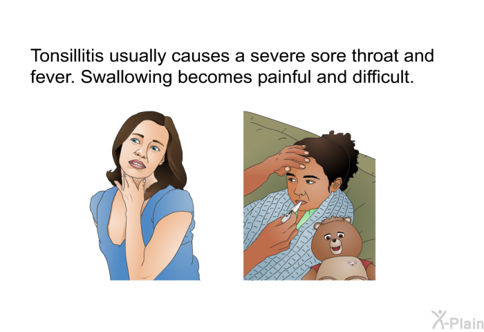 Tonsillitis usually causes a severe sore throat and fever. Swallowing becomes painful and difficult.