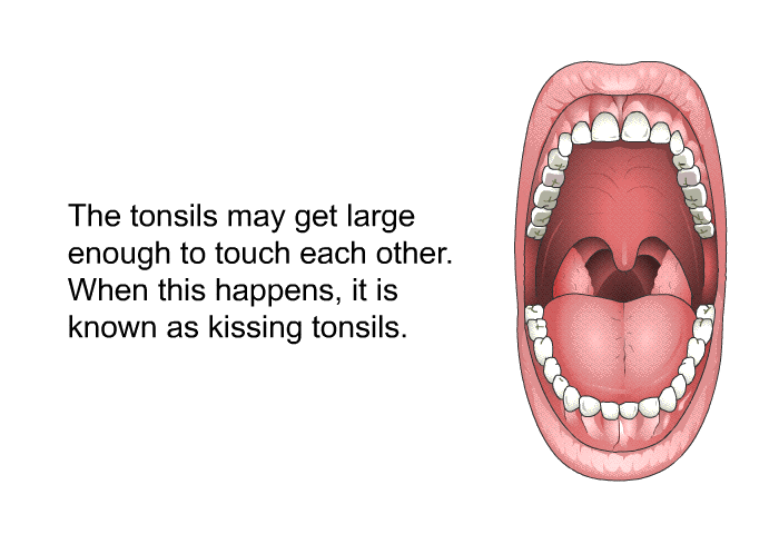 The tonsils may get large enough to touch each other. When this happens, it is known as kissing tonsils.