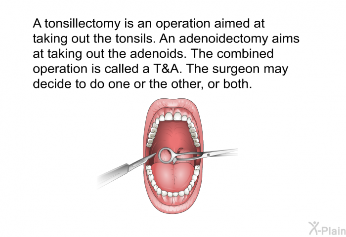 A tonsillectomy is an operation aimed at taking out the tonsils. An adenoidectomy aims at taking out the adenoids. The combined operation is called a T&A. The surgeon may decide to do one or the other, or both.