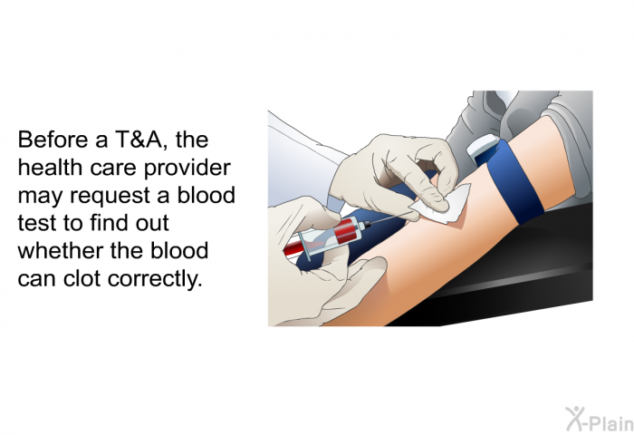 Before a T&A, the health care provider may request a blood test to find out whether the blood can clot correctly.