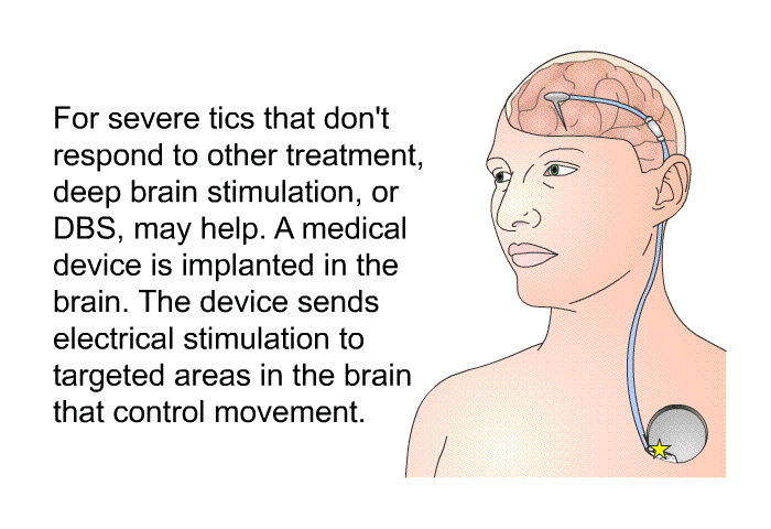 For severe tics that don't respond to other treatment, deep brain stimulation, or DBS, may help. A medical device is implanted in the brain. The device sends electrical stimulation to targeted areas in the brain that control movement.