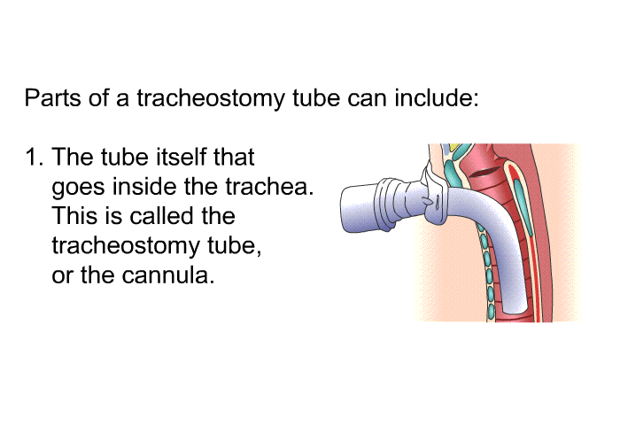 Parts of a tracheostomy tube can include:  The tube itself that goes inside the trachea. This is called the tracheostomy tube, or the cannula.