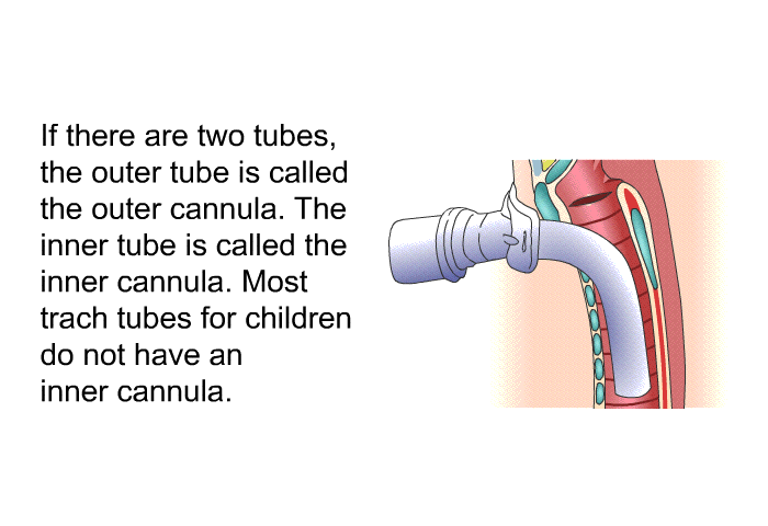 If there are two tubes, the outer tube is called the outer cannula. The inner tube is called the inner cannula. Most trach tubes for children do not have an inner cannula.