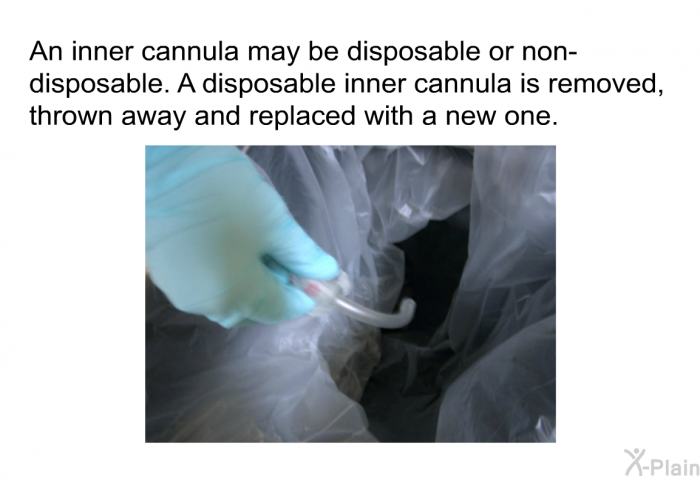 An inner cannula may be disposable or non-disposable. A disposable inner cannula is removed, thrown away and replaced with a new one.