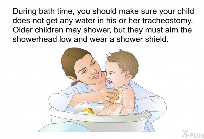 During bath time, you should make sure your child does not get any water in his or her tracheostomy. Older children may shower, but they must aim the showerhead low and wear a shower shield.