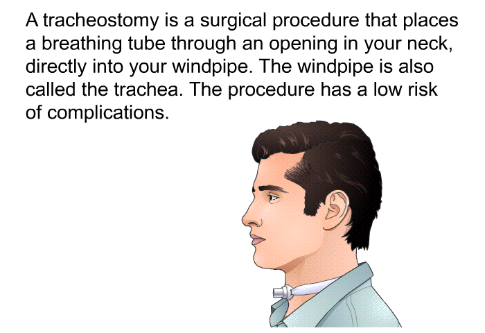A tracheostomy is a surgical procedure that places a breathing tube through an opening in your neck, directly into your windpipe. The windpipe is also called the trachea. The procedure has a low risk of complications.
