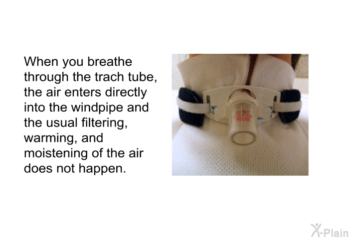 When you breathe through the trach tube, the air enters directly into the windpipe and the usual filtering, warming, and moistening of the air does not happen.